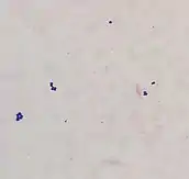 A few large, spherical, purple bacteria in small clusters on a faded pink background
