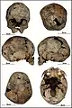 Burial 06 - Cranium