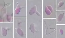 Oval to irregularly shaped single-celled yeast of Sporobolomyces salmonicolor showing characteristic "arthritic-finger"-shaped sterigmata