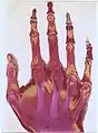 Original: X-Ray image of right hand;colored  1st. order equidensity-series using pseudo-solarization, B&W copies chromogenic developed